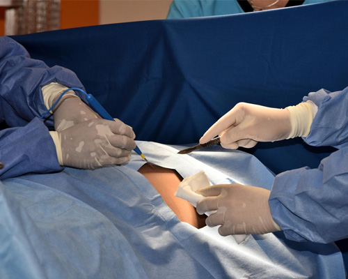 Minimally Invasive Cancer Surgeries in Modern Oncology: A Comprehensive Guide